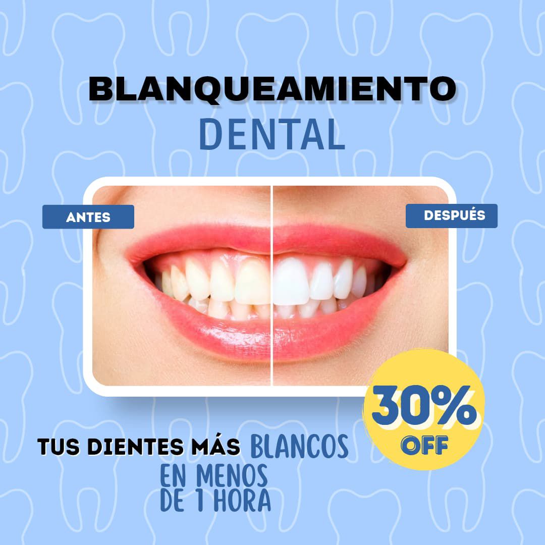 Blanqueamiento sin sensibilidad